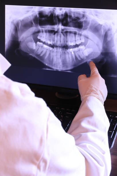 Best Emergency Dental Extractions in Sault Ste Marie, MI