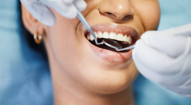Best Emergency Dentist for Lost Fillings or Crowns in Sault Ste Marie, MI