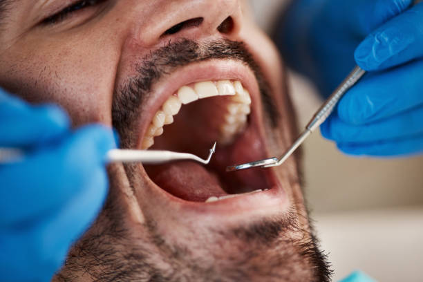 Best Emergency Dental Services for Seniors in Sault Ste Marie, MI
